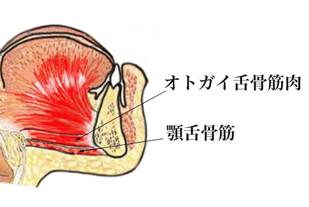 オトガイ矢状断