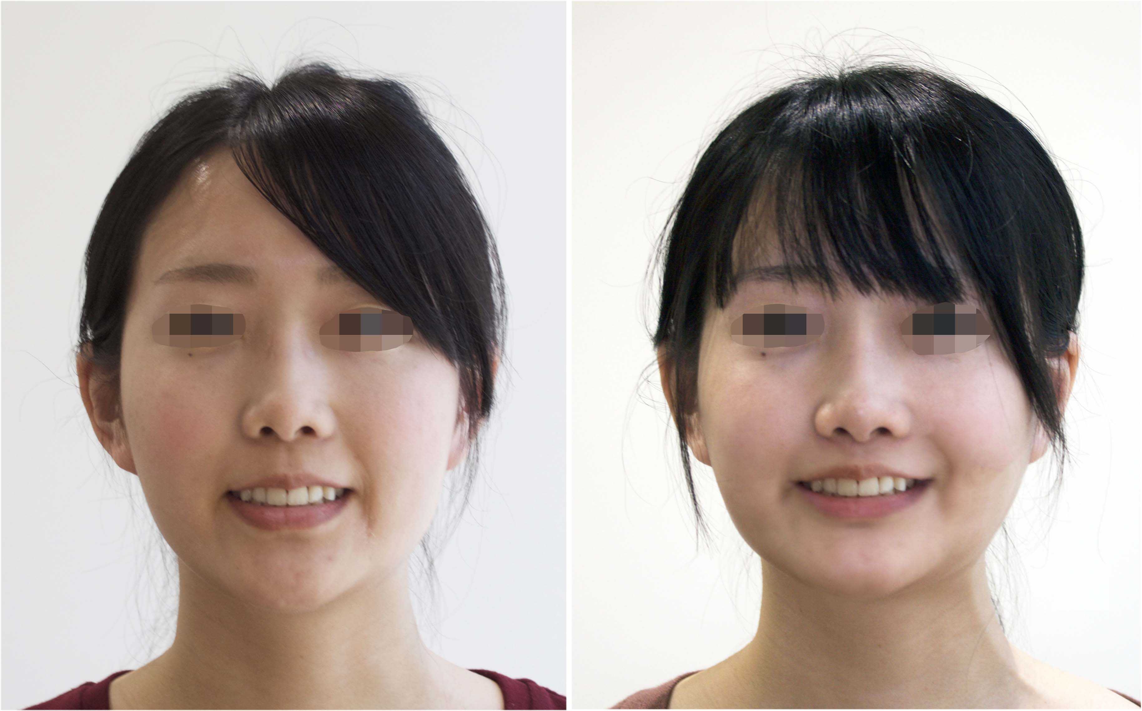 顔から姿勢を正す整顔術〜健美両立型のアプローチ〜 顔から姿勢を正す整顔術〜健美両立型のアプローチ〜 整