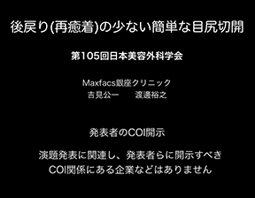 再癒着の少ない簡単な目尻切開