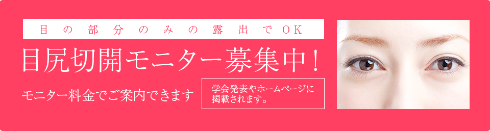 目尻切開モニター募集中