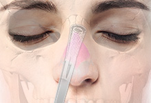 眉間を高くする施術 診療案内 マックスファクス銀座クリニック