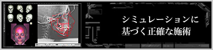 シミュレーションに基づく正確な施術