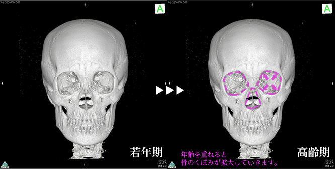 若年期と高齢期