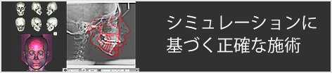 シミュレーションに基づく正確な施術